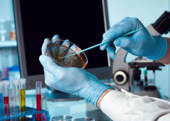 Ախտորոշիչ հավաքածուի ձեռքբերման գումարն ավելացվել է