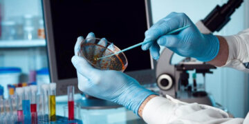 Ախտորոշիչ հավաքածուի ձեռքբերման գումարն ավելացվել է